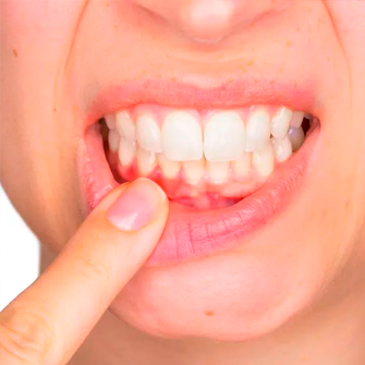 Periodoncia